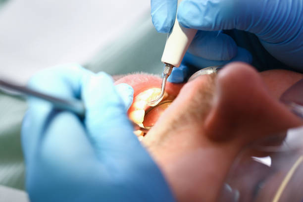 Best Root Canal Emergency Dentist  in Avalon, PA